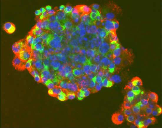 Επιστήμονες δημιούργησαν ανθρώπινα βλαστοκύτταρα μέσω κλωνοποίησης